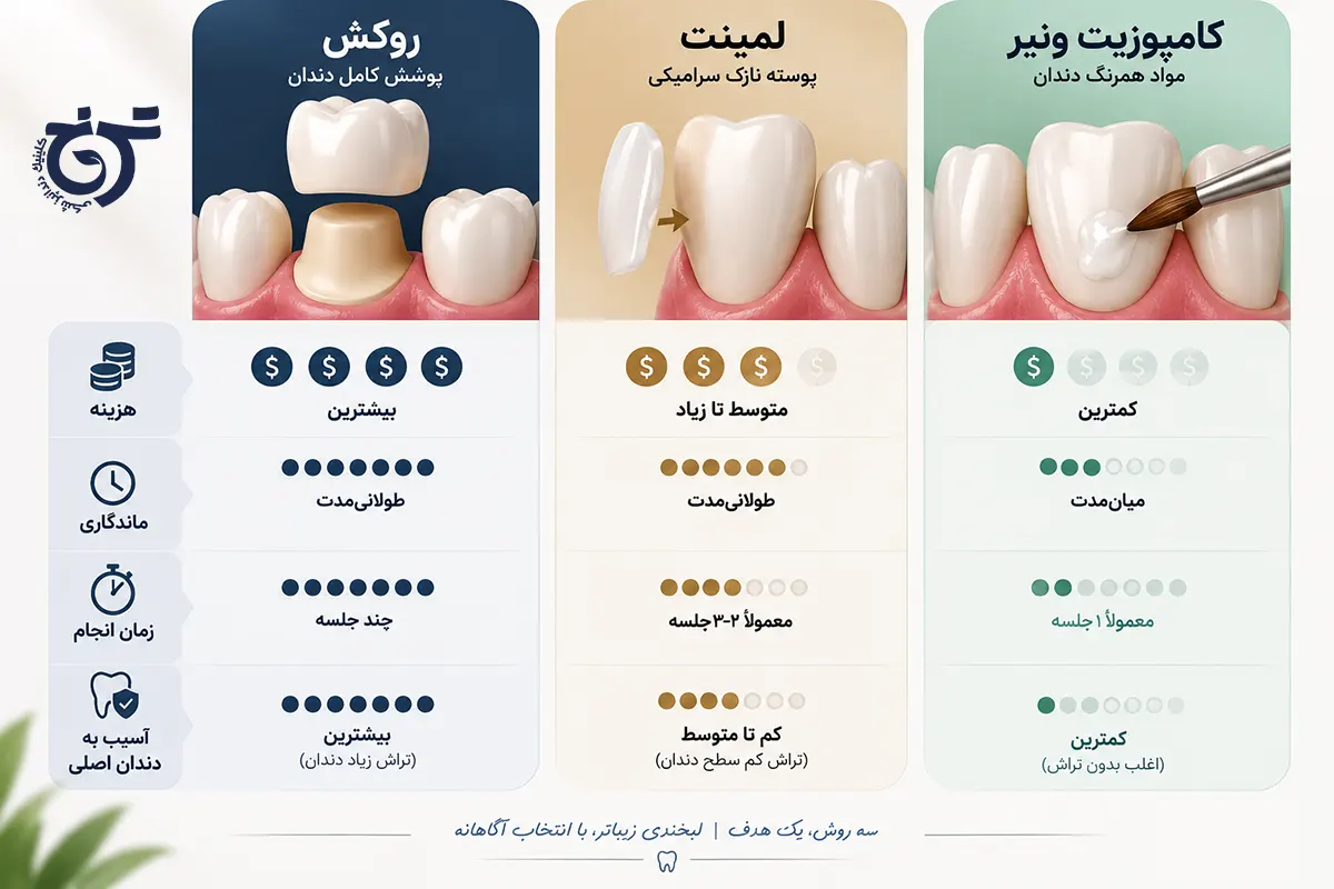 فرق لمینت و کامپوزیت