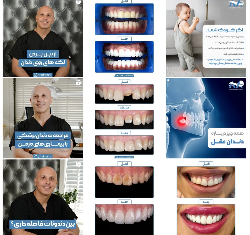 اینستاگرام دکتر علیرضا افراشی دندانپزشک