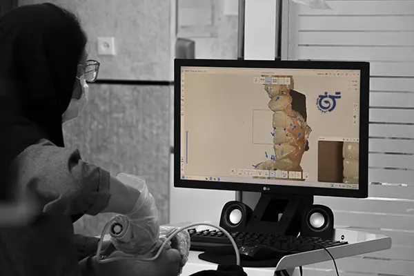 اسکنر دیجیتال در کلینیک دندانپزشکی ترنج