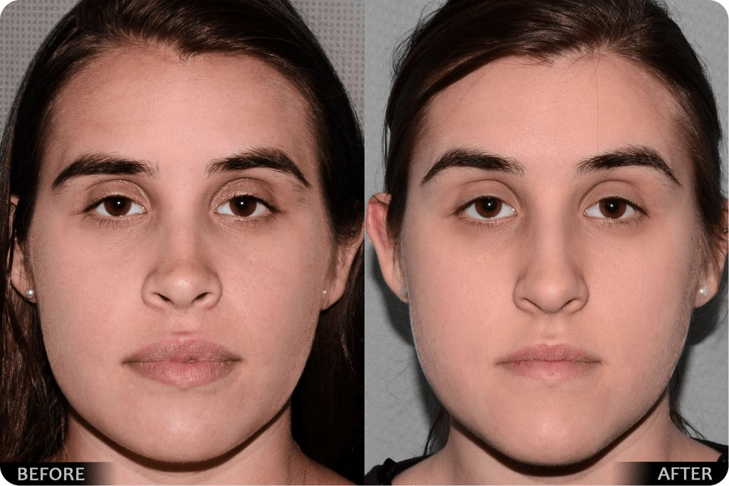نمونه جراحی فک و صورت