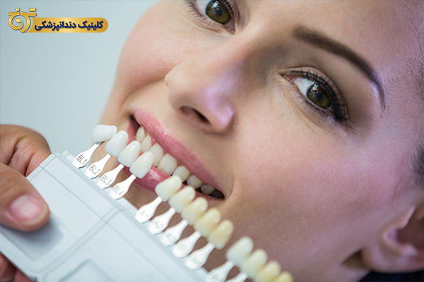 درمان کجی دندان با کامپوزیت