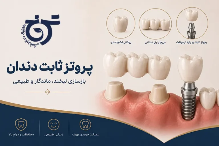 انواع پروتزهای دندانی