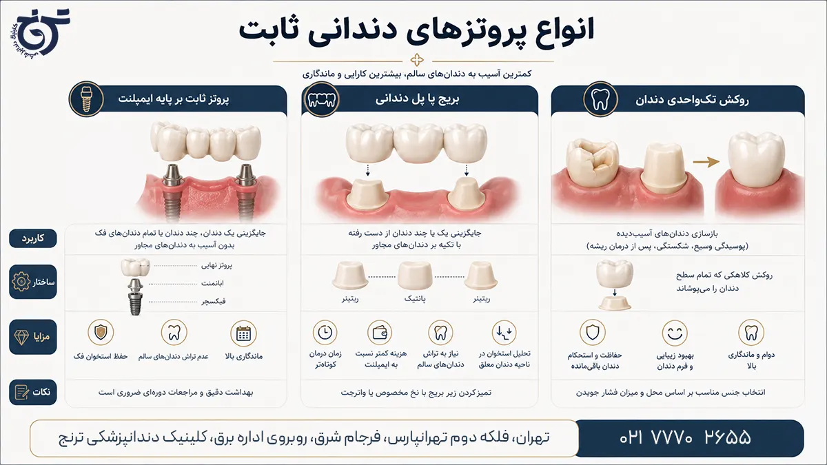 انواع پروتز ثابت دندان