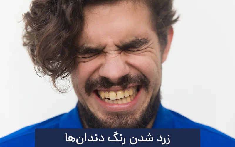 علت زرد شدن رنگ دندان ها