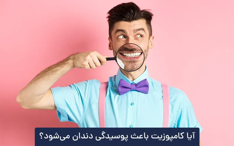 آیا کامپوزیت دندان باعث پوسیدگی می شود؟