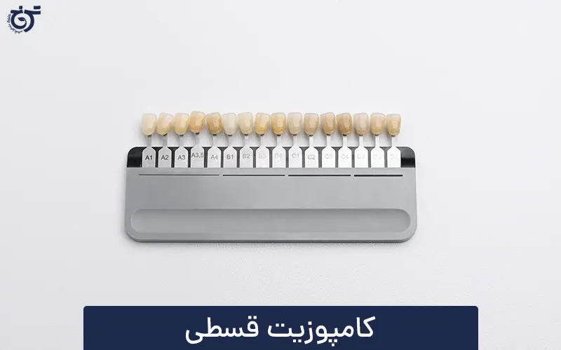 کامپوزیت قسطی در شرق تهران