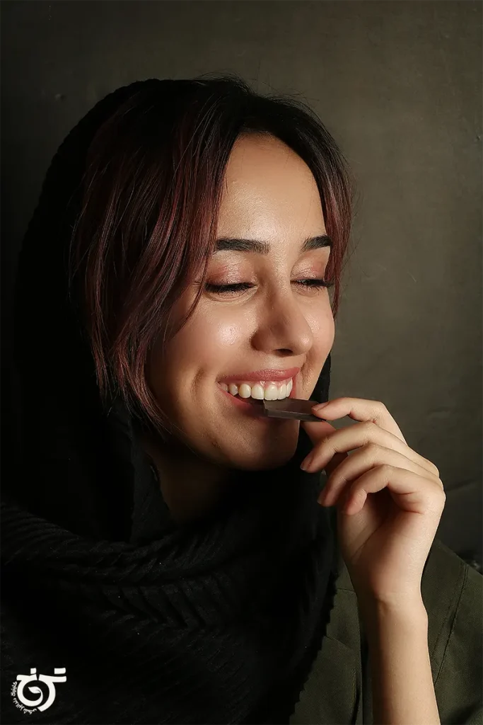 کامپوزیت دندان در تهرانپارس