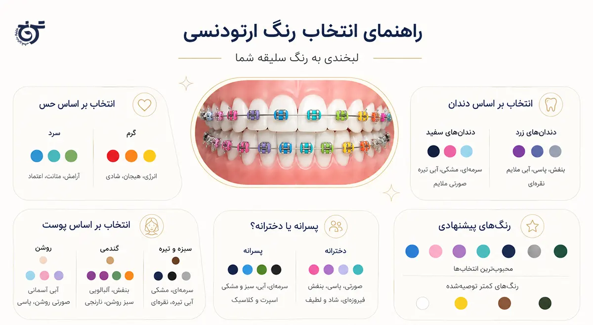 راهنمای انتخاب بهترین رنگ برای ارتودنسی