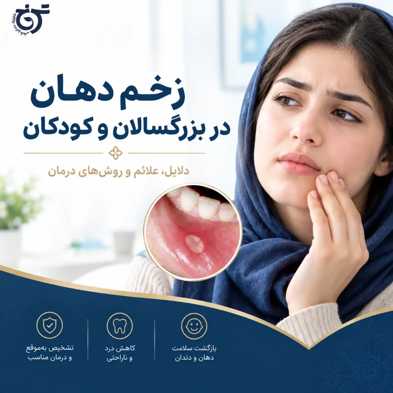 زخم دهان