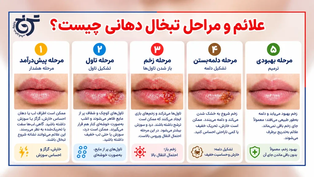 تبخال دهانی